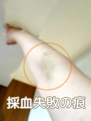 失敗