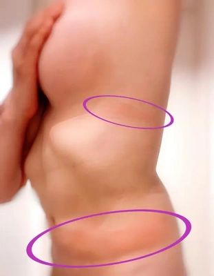 お腹もっこり