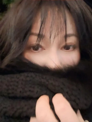 昨日は、顔面が針山です