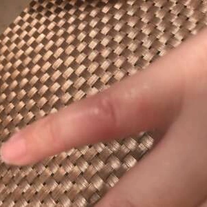 関節無くなった！