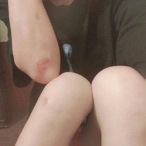 この傷も治りました。