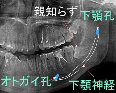 大変なことに…