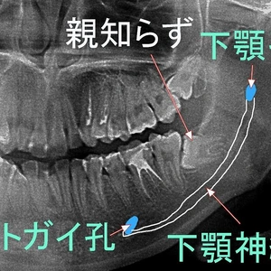 大変なことに…